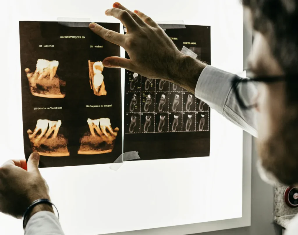 كيف تختار الفينير المناسب لابتسامتك؟