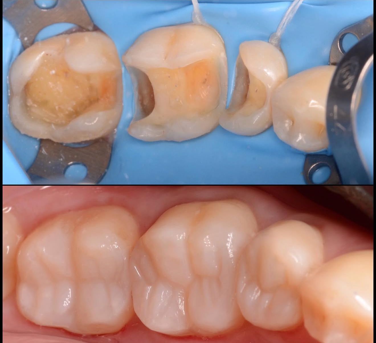 تجميل الاسنان