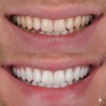 طرق فعالة للحفاظ على بياض الأسنان